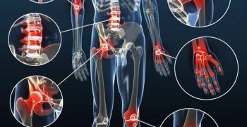 Kireçlenme şikayetlerinin azaltılmasında yeşil çayın yararlı olduğu bildiriliyor