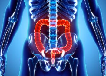 Ülseratif kolit hastalarında turp tohumu kesin çözüm mü?