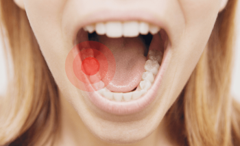 Diş çürümelerine karşı koruyan besinler var mı?